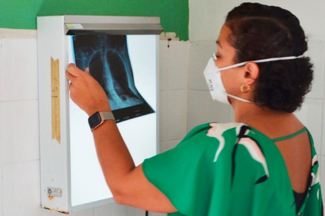 Transmissão da tuberculose não tem sazonalidade; casos da doença podem surgir ao longo do ano