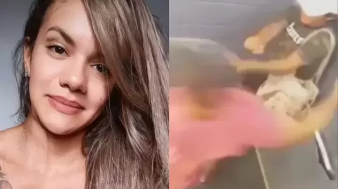 Mulher agredida com mais de 60 socos pelo namorado mostra rosto após cirurgia