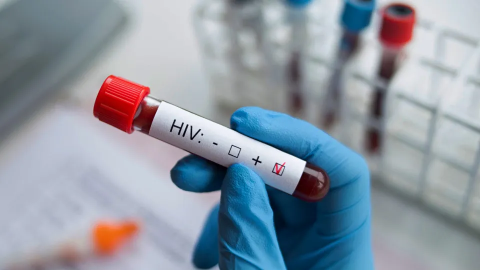 Progresso em pesquisas do HIV: Estamos perto da cura?