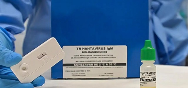 Anvisa aprova teste rápido que detecta hantavirose em 20 minutos