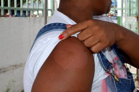 Janeiro Roxo reforça combate à hanseníase em Feira de Santana