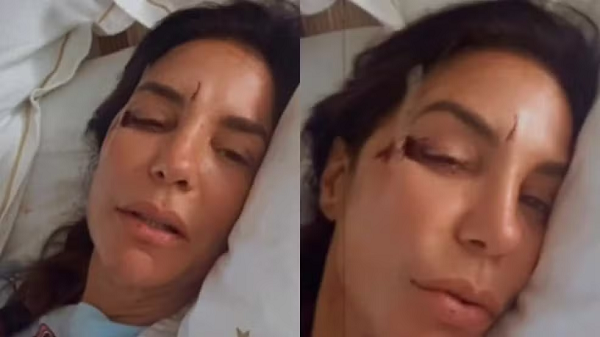Especialista explica desmaio de Ivete Sangalo após desidratação; entenda