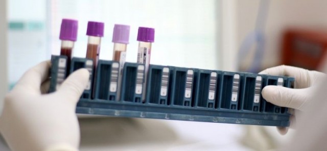 Bahia já conta com pontos de coleta para exame genético de doenças raras no SUS