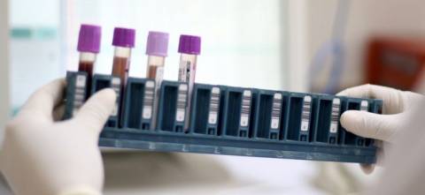 Bahia já conta com pontos de coleta para exame genético de doenças raras no SUS